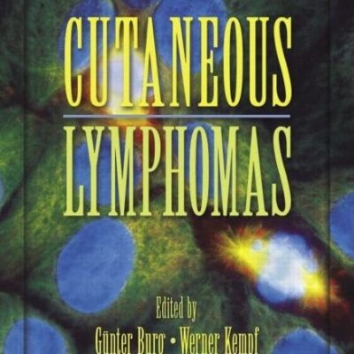 Cutaneous Lymphomas: 32 (Basic and Clinical Dermatology)