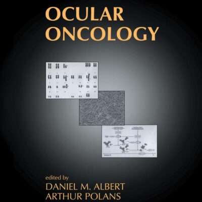 Ocular Oncology