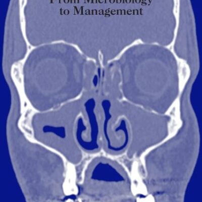 Sinusitis From Microbiology to Management