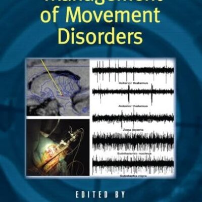 Surgical Management of Movement Disorders: 77 (Neurological Disease and Therapy)