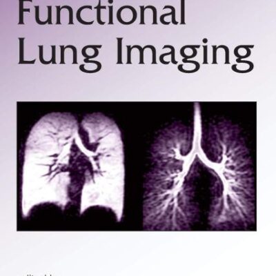 Functional Lung Imaging: 200 (Lung Biology in Health and Disease)
