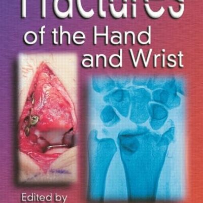 FRACTURES OF THE HAND AND WRIST