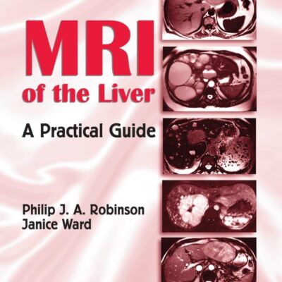 MRI of the Liver: A Practical Guide