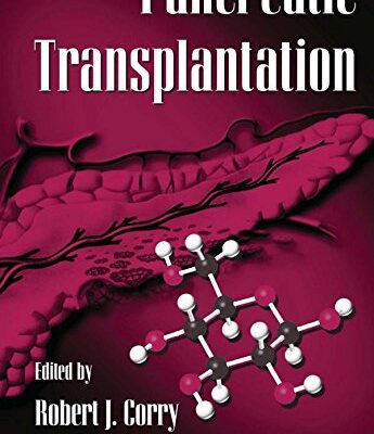 Pancreatic Transplantation