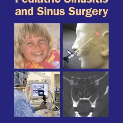 Pediatric Sinusitis and Sinus Surgery