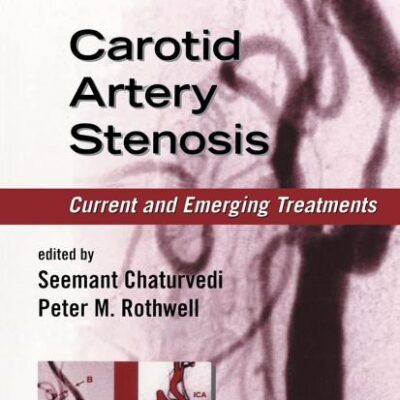 Carotid Artery Stenosis: Current and Emerging Treatments (Neurological Disease and Therapy)