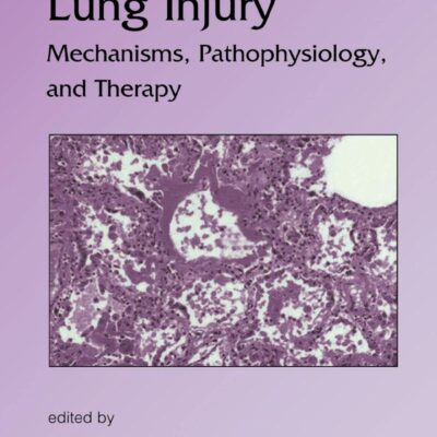 Lung Injury: Mechanisms, Pathophysiology, and Therapy: 196 (Lung Biology in Health and Disease)