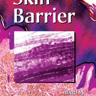 Skin Barrier