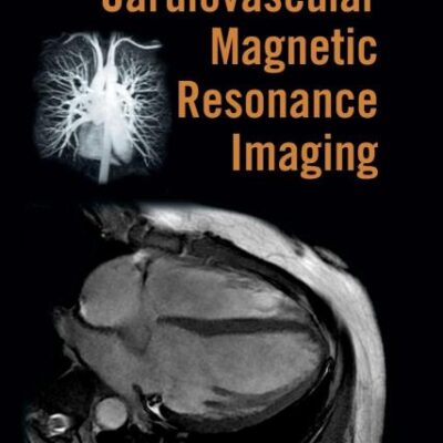 Handbook of Cardiovascular Magnetic Resonance Imaging: 60 (Fundamental and Clinical Cardiology)