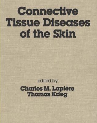 CONNECTIVE TISSUE DISEASES OF THE SKIN