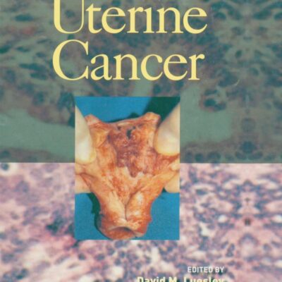 Uterine Cancer