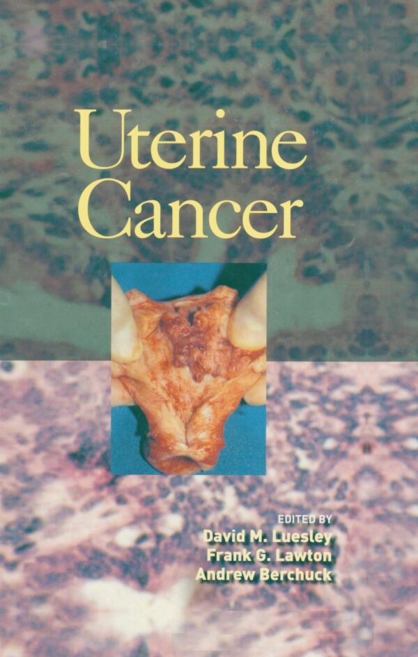 Uterine Cancer