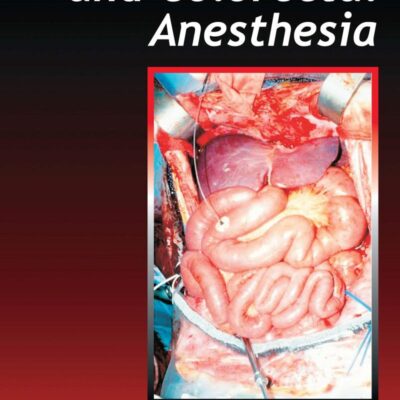 Gastrointestinal and Colorectal Anesthesia