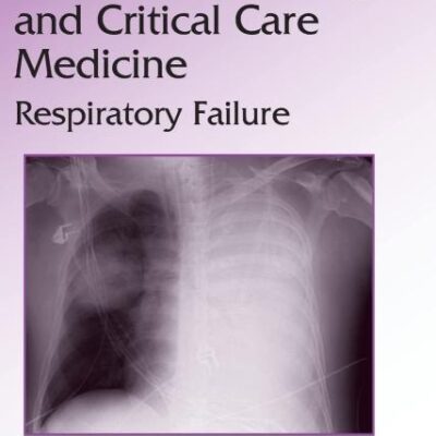 Practical Pulmonary and Critical Care Medicine: Respiratory Failure: 213 (Lung Biology in Health and Disease)