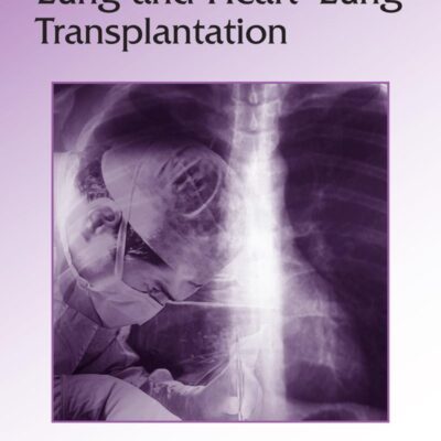 Lung and Heart-Lung Transplantation: 217 (Lung Biology in Health and Disease)