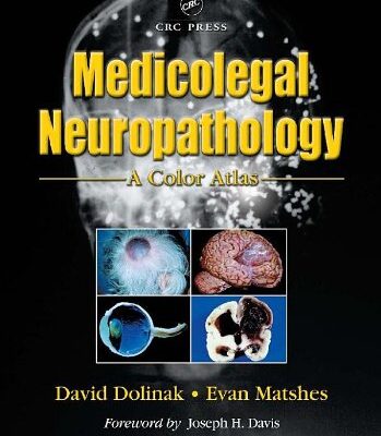 Medicolegal Neuropathology: A Color Atlas