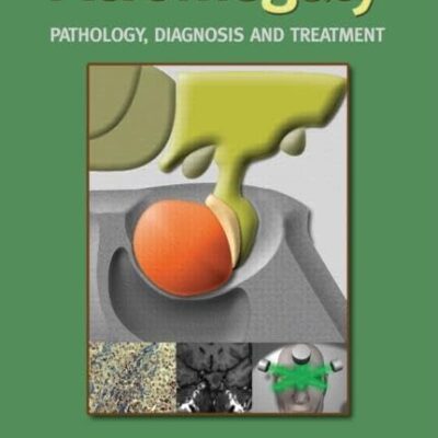 Acromegaly: Pathology, Diagnosis and Treatment