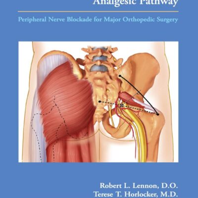 MAYO CLINIC ANALGESIC PATHWAY PERIPHERAL NERVE BLOCKADE FOR MAJOR