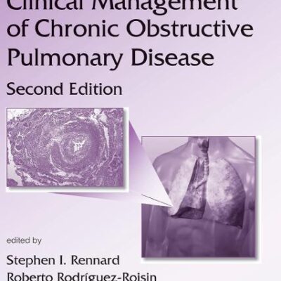CLINICAL MANAGEMENT OF CHRONIC OBSTRUCTIVE PULMONARY DISEASE, SECOND EDITION (LUNG BIOLOGY IN HEALTH AND DISEASE)