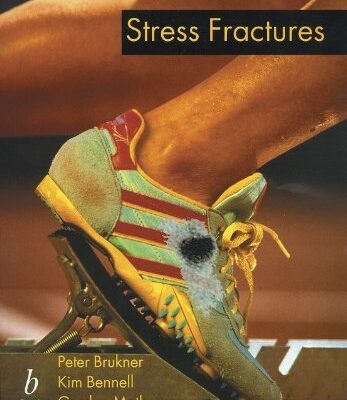 Stress Fractures