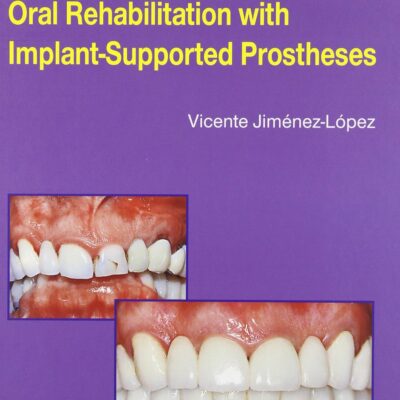 ORAL REHABILITATION WITH IMPLANT SUPPORTED PROSTHESES (HB 1999)