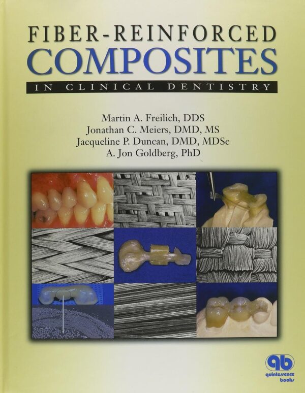 Fiber-reinforced Composites in Clinical Dentistry