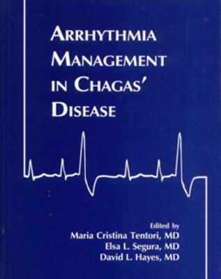 Arrhythmia Management in Chagas′ Disease