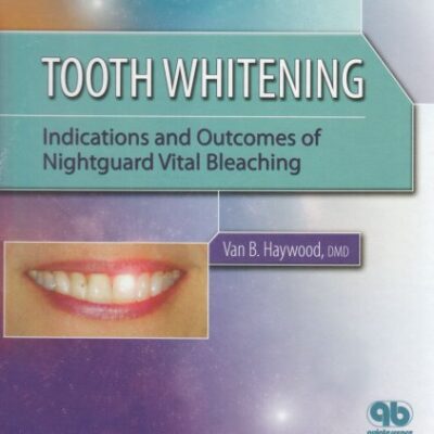 Tooth Whitening: Indications and Outcomes of Nightguard Vital Bleaching