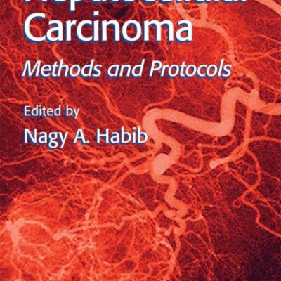 Hepatocellular Carcinoma: Methods and Protocols (Hb)