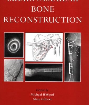 Microvascular Bone Reconstruction