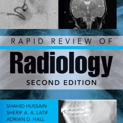 RAPID REVIEW OF RADIOLOGY 2ED (PB 2026) (Medical Rapid Review)