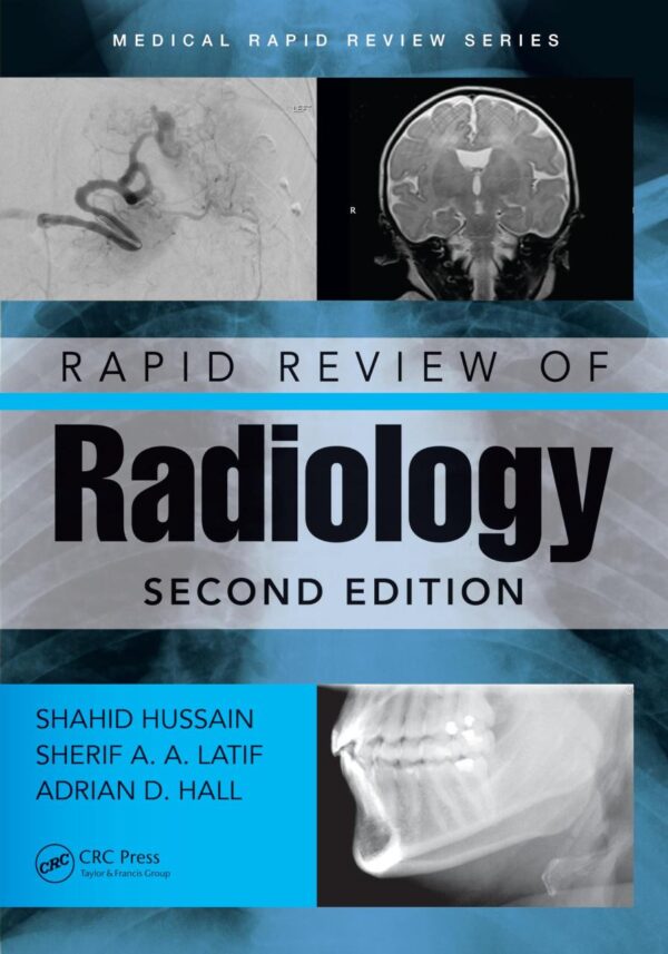 RAPID REVIEW OF RADIOLOGY 2ED (PB 2026) (Medical Rapid Review)