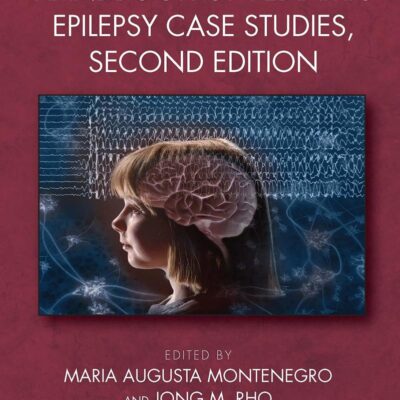 Handbook of Pediatric Epilepsy Case Studies