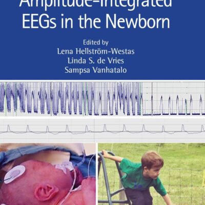 An Atlas of Amplitude-Integrated Eegs in the Newborn
