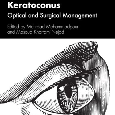 Keratoconus: Optical and Surgical Management
