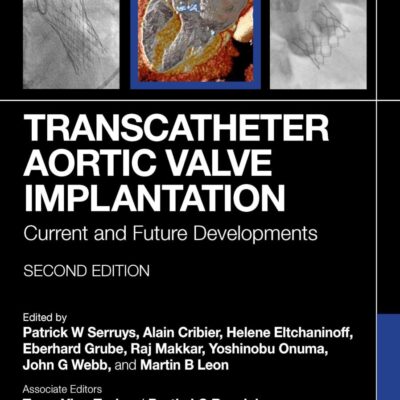 Transcatheter Aortic Valve Implantation: Current and Future Developments