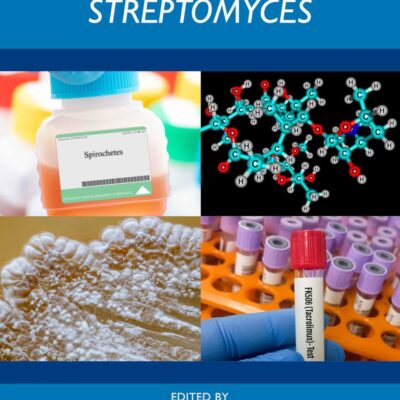 Bioeconomy of Streptomyces
