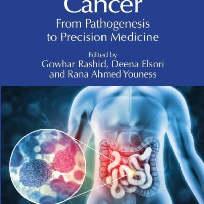 Colorectal Cancer: From Pathogenesis to Precision Medicine
