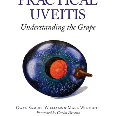 Practical Uveitis: Understanding the Grape