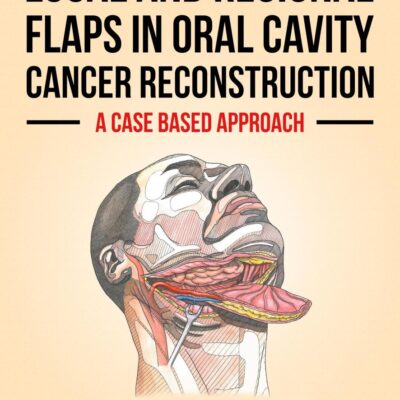 Local and Regional Flaps in Oral Cavity Cancer Reconstruction: A Case-based Approach
