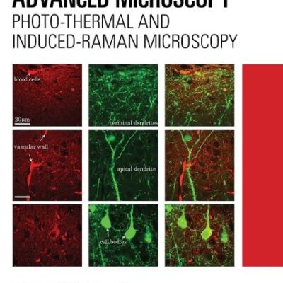 Advanced Microscopy: Photo-thermal and Induced-raman Microscopy