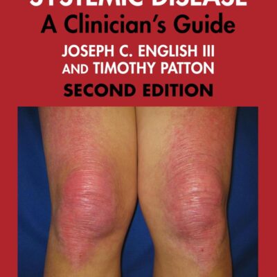 SKIN AND SYSTEMIC DISEASE A CLINICIANS GUIDE 2ED (HB 2026)