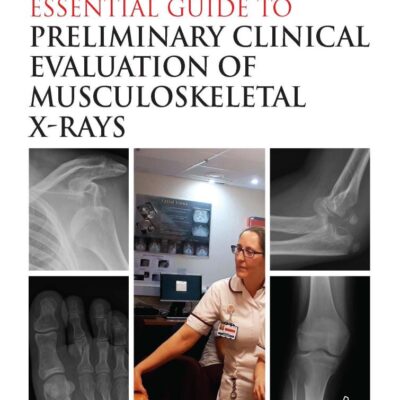 Clark’s Essential Guide to Preliminary Clinical Evaluation of Musculoskeletal X-rays: Evaluating and Commenting on Images (Clark's Companion Essential Guides)
