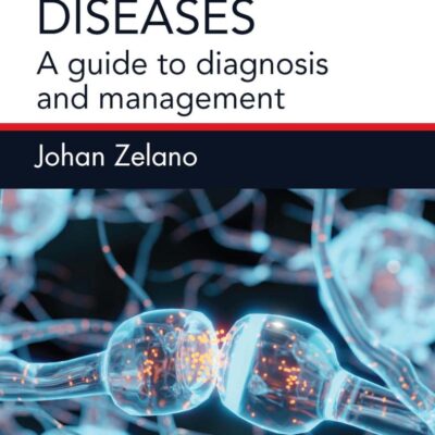 EPILEPSY IN OTHER BRAIN DISEASES A GUIDE TO DIAGNOSIS AND MANAGEMENT (PB 2025)