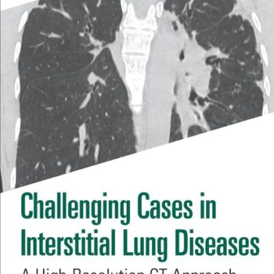 Challenging Cases in Interstitial Lung Diseases: A High-resolution Ct Approach