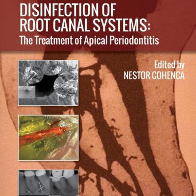 Disinfection of Root Canal Systems: The Treatment of Apical Periodontitis