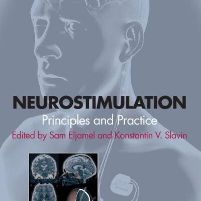 Neurostimulation: Principles and Practice
