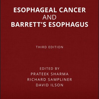 Esophageal Cancer and Barrett's Esophagus