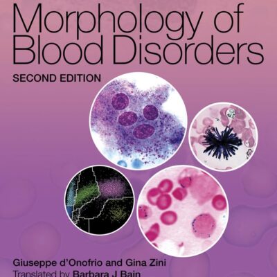 MORPHOLOGY OF BLOOD DISORDERS 2ED