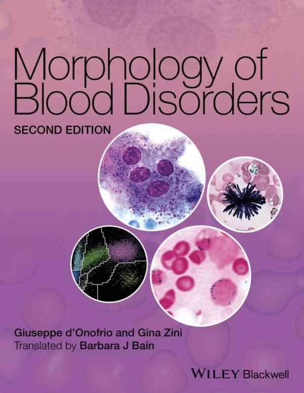 MORPHOLOGY OF BLOOD DISORDERS 2ED